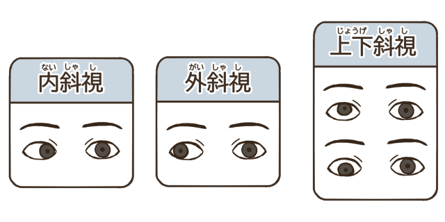 写真で片目の向きが違う…それ斜視のサインかも | 旗の台整体院